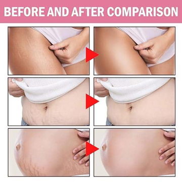 ADEUS Skin Firming Cream – Visible Results on Belly, Thighs & Glutes in Weeks - Multi functional & Skin tightener – Reduces Cellulite, Stretch Marks & Sagging – Collagen-Boosting, Firms & Lifts