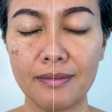 Dr. Alies Professional 15% Vitamin C Face Serum – with 1% Alpha Arbutin, Vitamin E & Ferulic Acid – Brightens Skin - Remove Dark Spots & Pigmentation, Fades Dark Spots, Evens Skin Tone