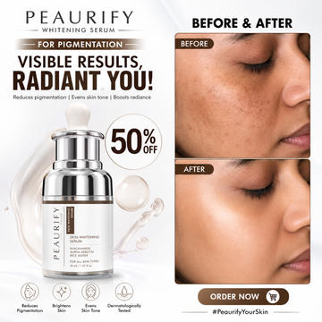 Peaurify Whitening Serum – For Pigmentation & Uneven Skin Tone – Reduces Pigmentation, Brightens Skin, Evens Skin Tone – Lightweight, Fast-Absorbing – Dermatologically Tested