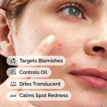 Clear Breakouts in 1 Hour | The Ordinary Powder-to-Cream + Ordinary Niacinamide Serum | Fastest Solution to reduce Acne, Spots & Redness