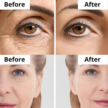 May & Mary Spicule Retinol & Collagen PDRN Cream | Micro-Spicule Technology with Retinol, Collagen & PDRN | Reduces Wrinkles, Pores & Improves Skin Texture