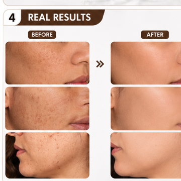 Peaurify Whitening Serum – For Pigmentation & Uneven Skin Tone – Reduces Pigmentation, Brightens Skin, Evens Skin Tone – Lightweight, Fast-Absorbing – Dermatologically Tested