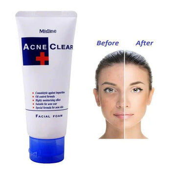 Mistine Acne Clear Face Wash Facial Foam 85 ml