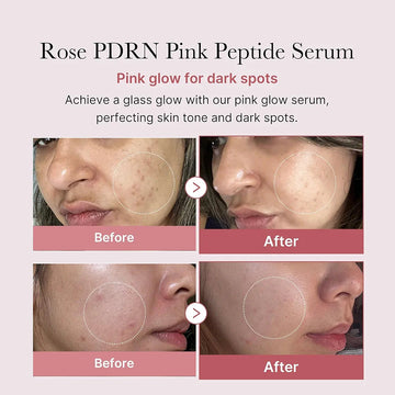 Medicube PDRN pdrn Pink Peptide Serum 30ml